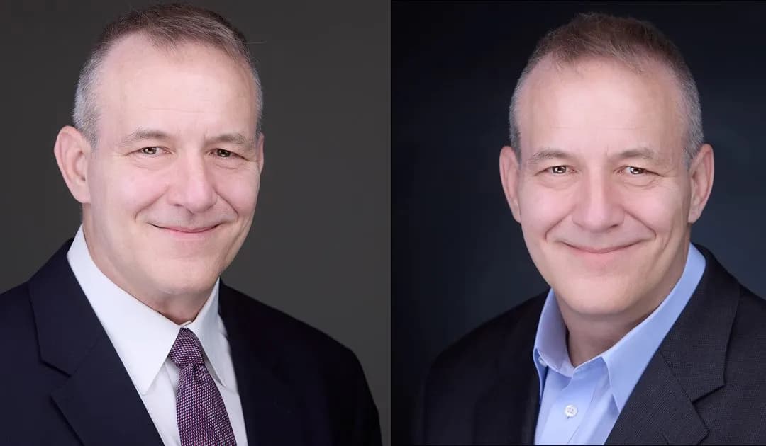 Which Side of My Face is Better?